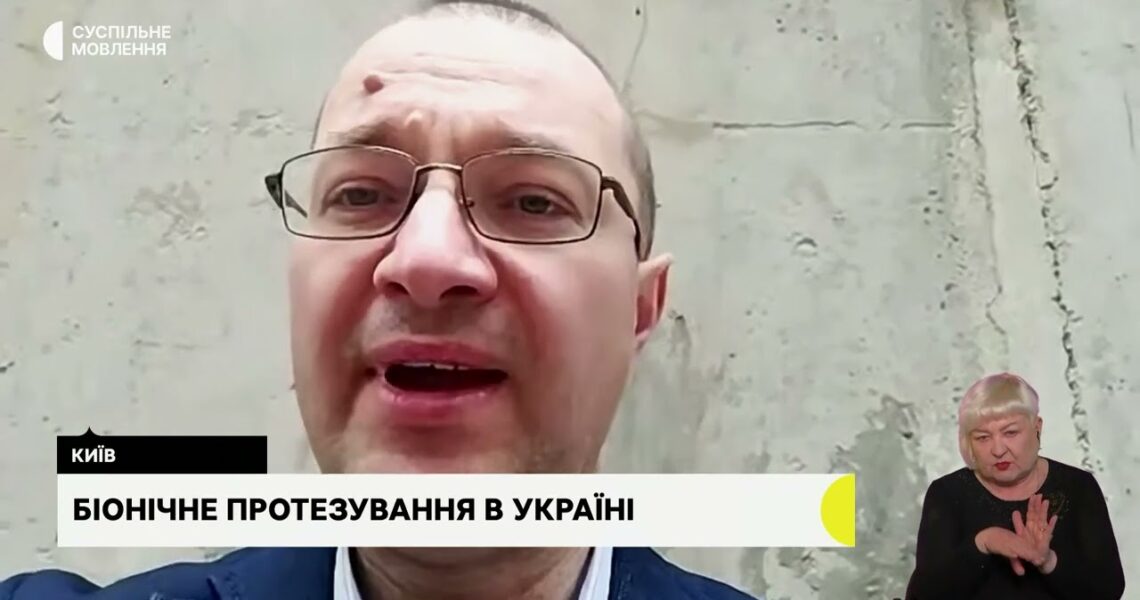 Біонічне протезування. Гостьова студія з Віталієм Музиченко, гендиректором Фонду.