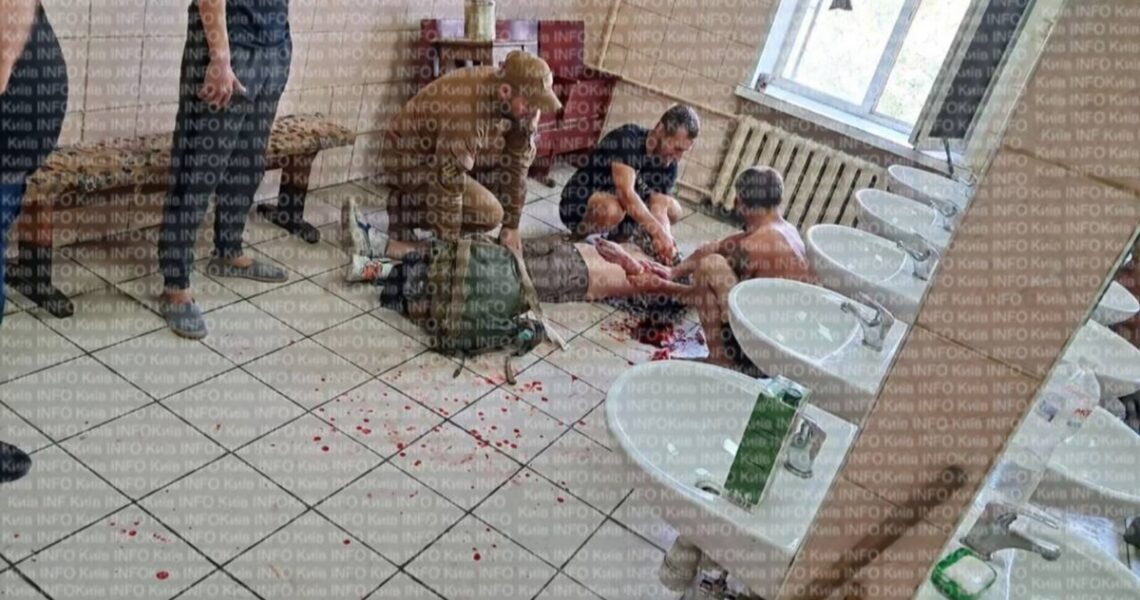 Новини Києва - У Києві мобілізований порізав собі руки та шию на збірному пункті
