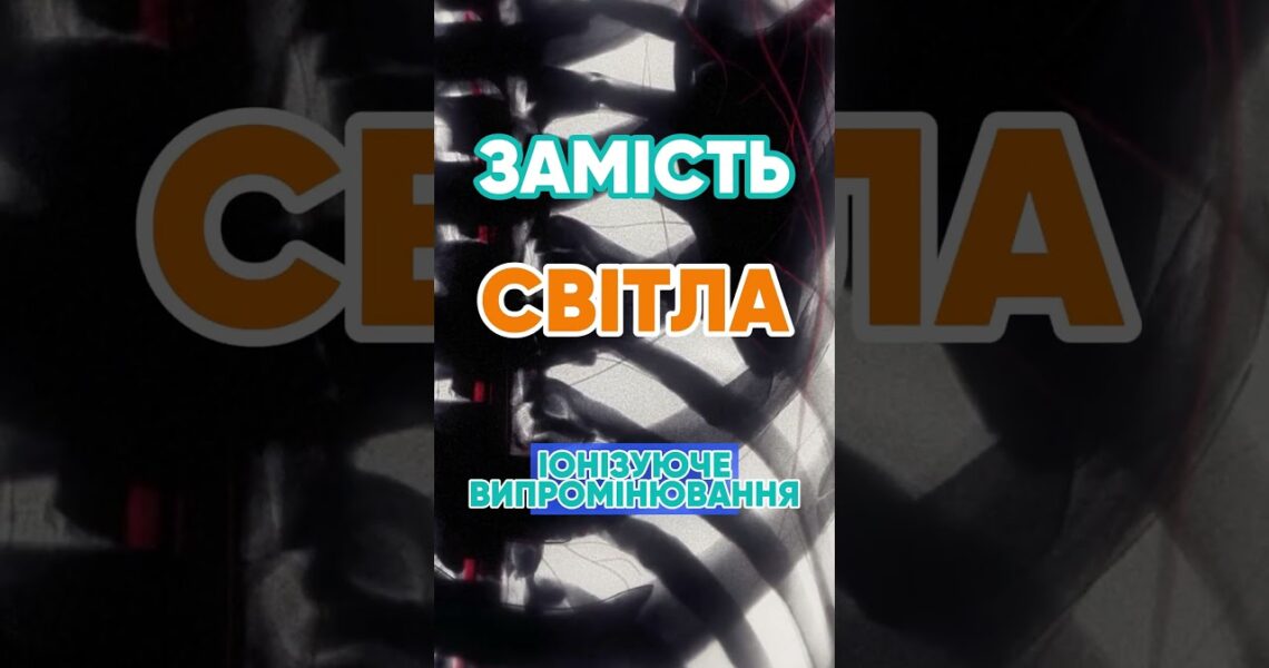 Чому рентген показує кістки? 🦴 #наука #цікаво #рентген #медицина